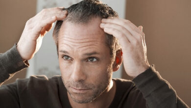 Le meilleur traitement pour la perte de cheveux chez les hommes Un guide simple